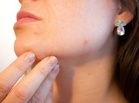 traiter efficacement acné