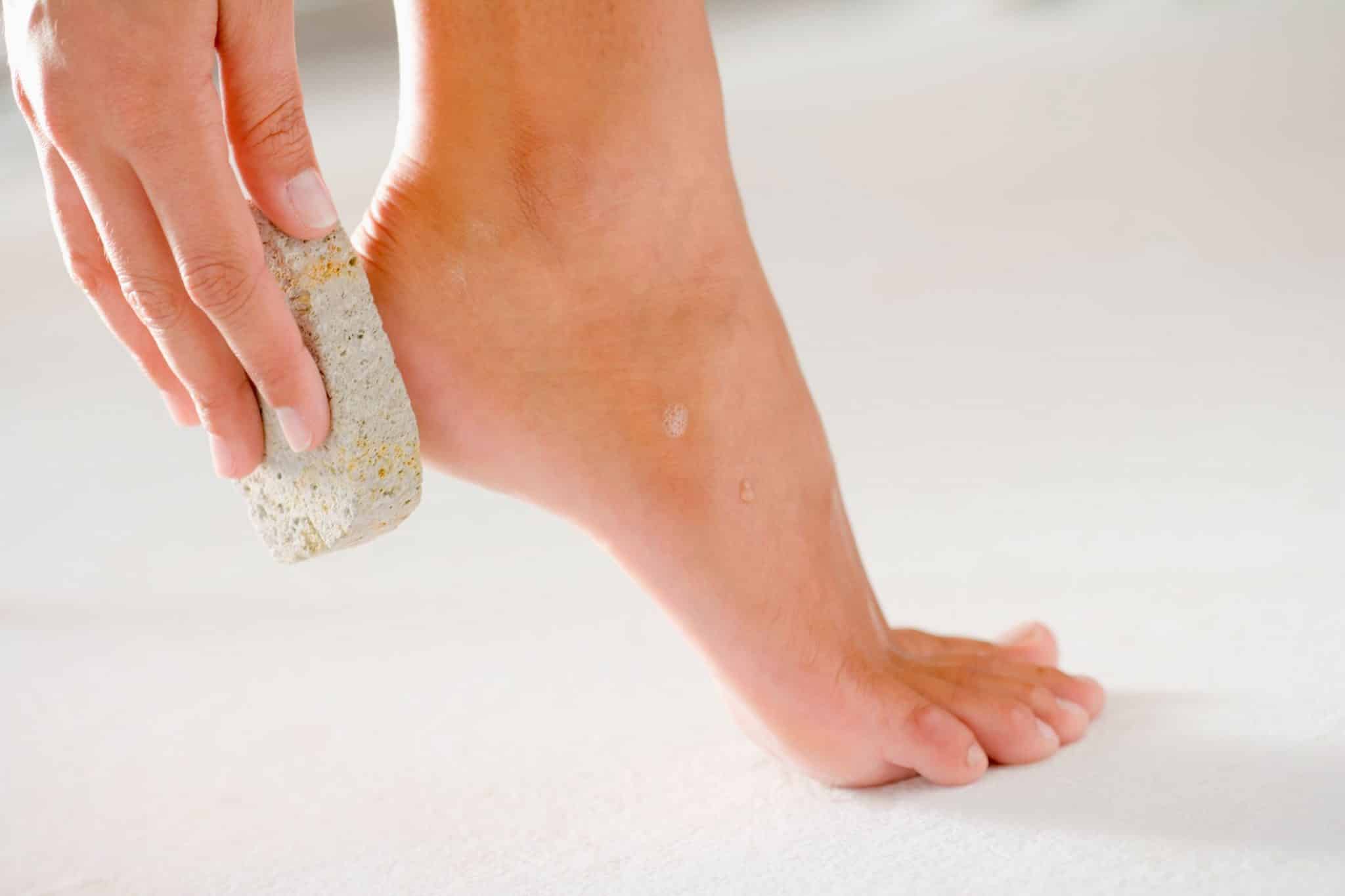 Comment avoir des talons parfaits : tous les secrets pour des pieds